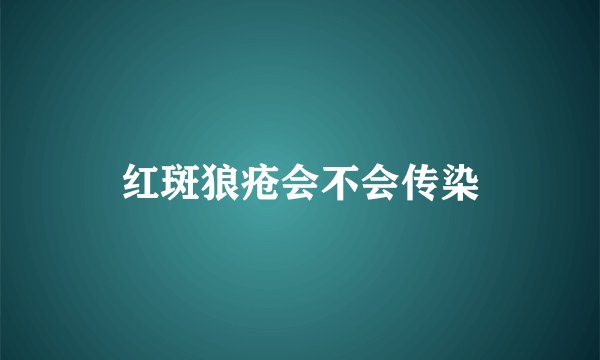红斑狼疮会不会传染