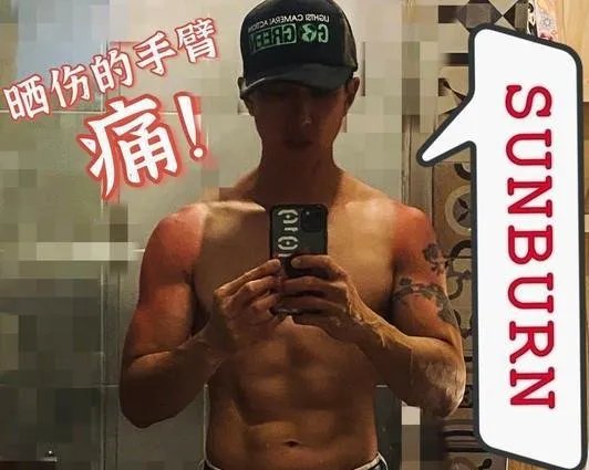 吴尊晒晒伤后的照片，这是在秀肌肉吗？