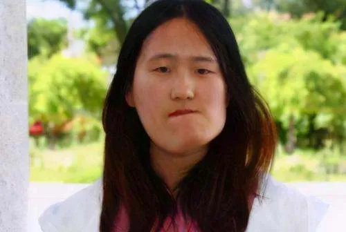 歪脸女孩赵宏秋整容成功后舍百万年薪当老师，后来怎样了？