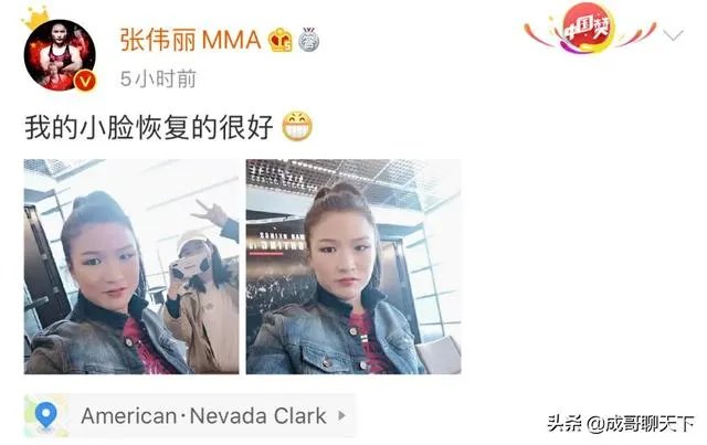 UFC冠军赛后，乔安娜需要进行整形手术而张伟丽却完全不需要，这是为什么？你怎么看？