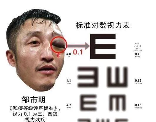 曝邹市明被逼带伤比赛，经纪公司表示邹市明先违约，你怎么看？