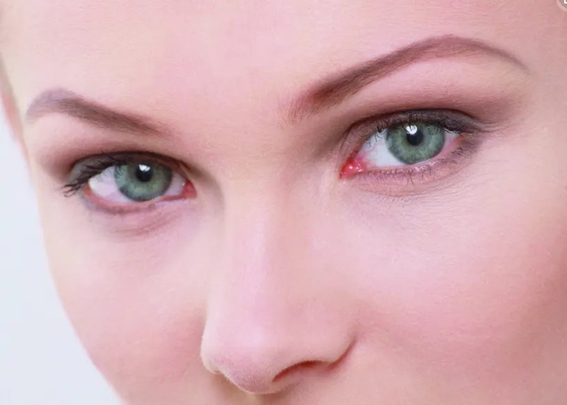 鼻翼整形要多少钱