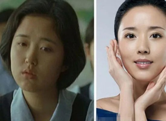 颜丹晨整容前后照片曝光 典型大饼脸形如大妈