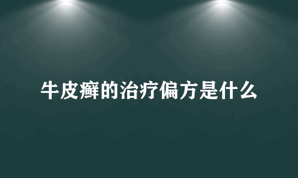 牛皮癣的治疗偏方是什么