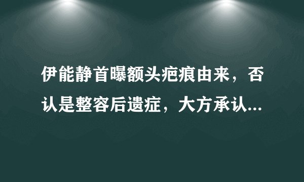 伊能静首曝额头疤痕由来，否认是整容后遗症，大方承认割过双眼皮