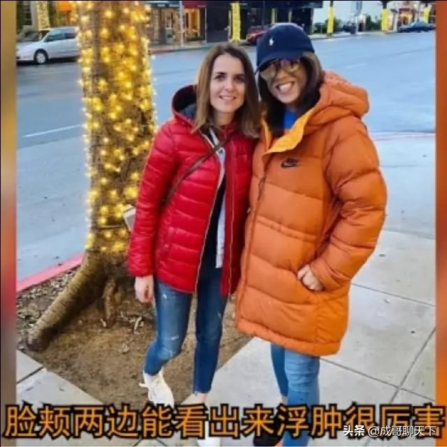 UFC冠军赛后，乔安娜需要进行整形手术而张伟丽却完全不需要，这是为什么？你怎么看？