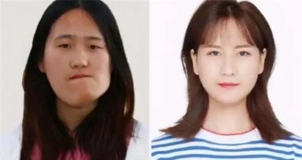 还记得“歪脸女孩”赵宏秋吗?整容变女神,弃百万年薪当老师,你怎么看?