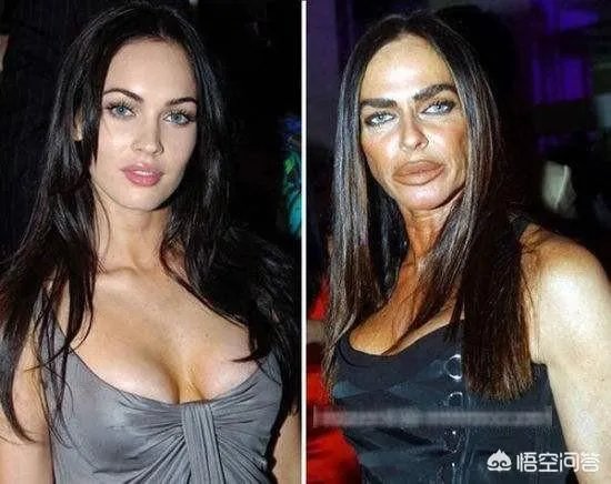 医疗美容（医美）与整形美容的差别是什么？