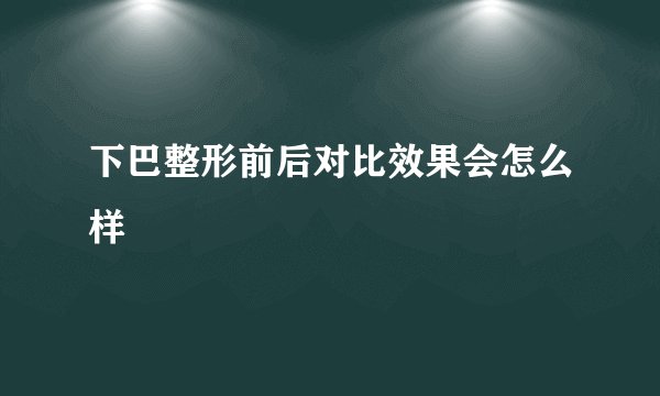 下巴整形前后对比效果会怎么样