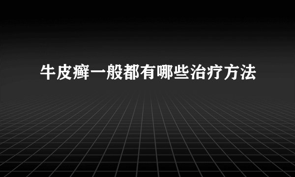 牛皮癣一般都有哪些治疗方法