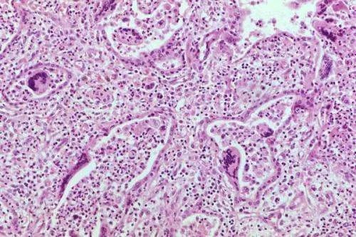 美国单日新增新冠肺炎超7.4万例，美国为何防不住疫情？