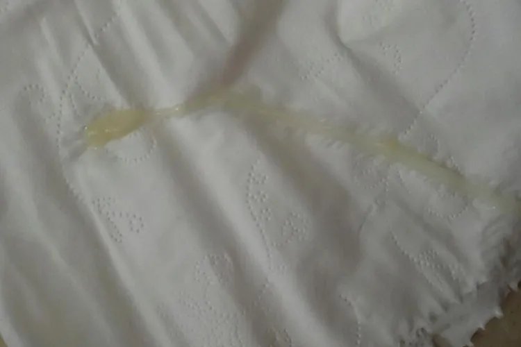 女生正常白带图片