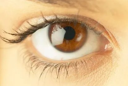 割双眼皮多久恢复呢