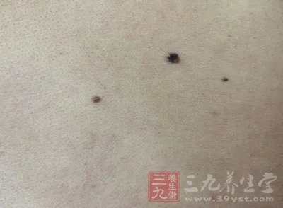 身上有没有癌一看这就知道