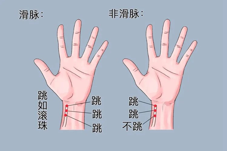如何把脉看怀孕图解