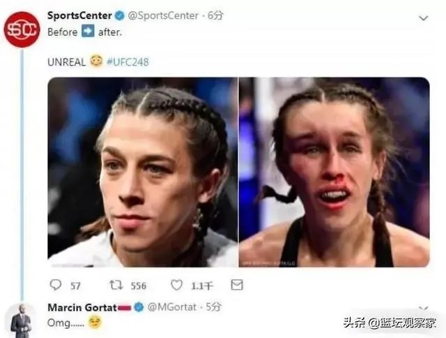 UFC冠军赛后，乔安娜需要进行整形手术而张伟丽却完全不需要，这是为什么？你怎么看？