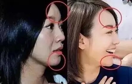 闫妮为什么越来越漂亮