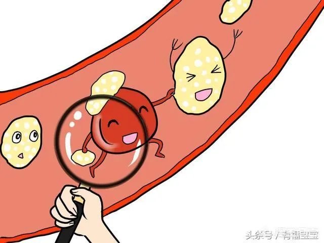 血管堵塞,身体会发出哪些求救信号?吃什么食物可以疏通血管?