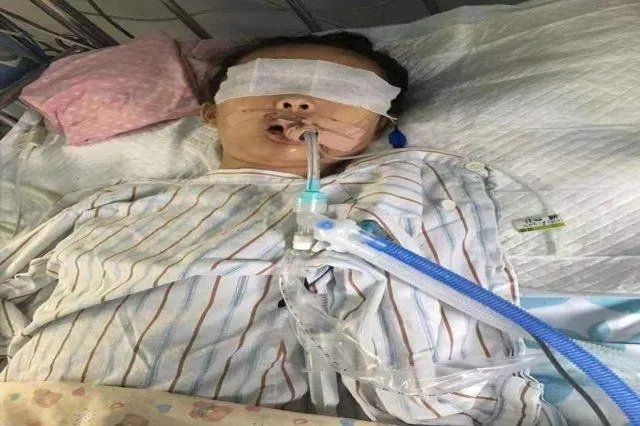 喉咙插管呼吸图片