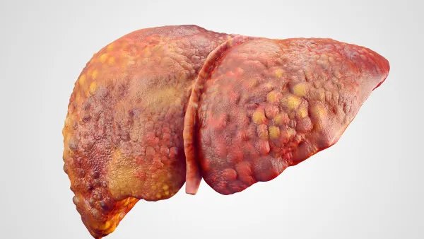 谷丙转氨酶高的危害