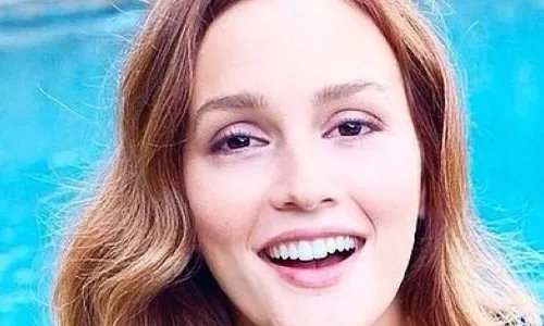 缩小鼻翼哪做的好