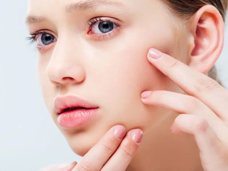 脸上毛孔大怎么办