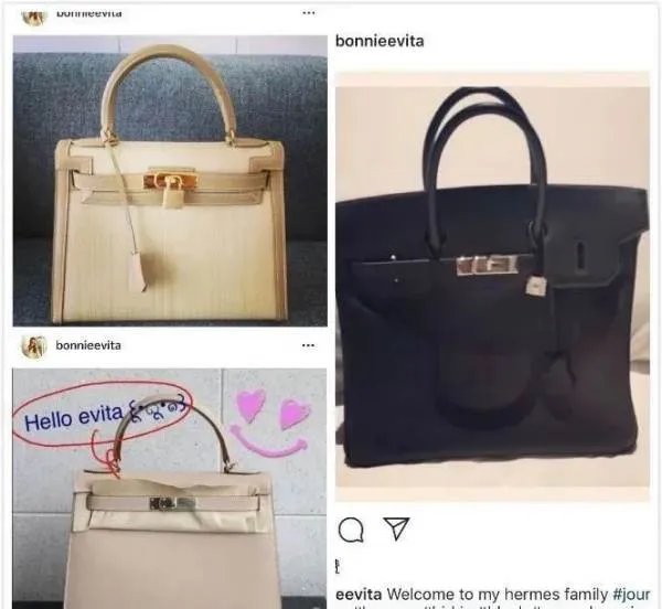 女子微整失败后崩溃,有哪些知名人物是因为整容死亡的?