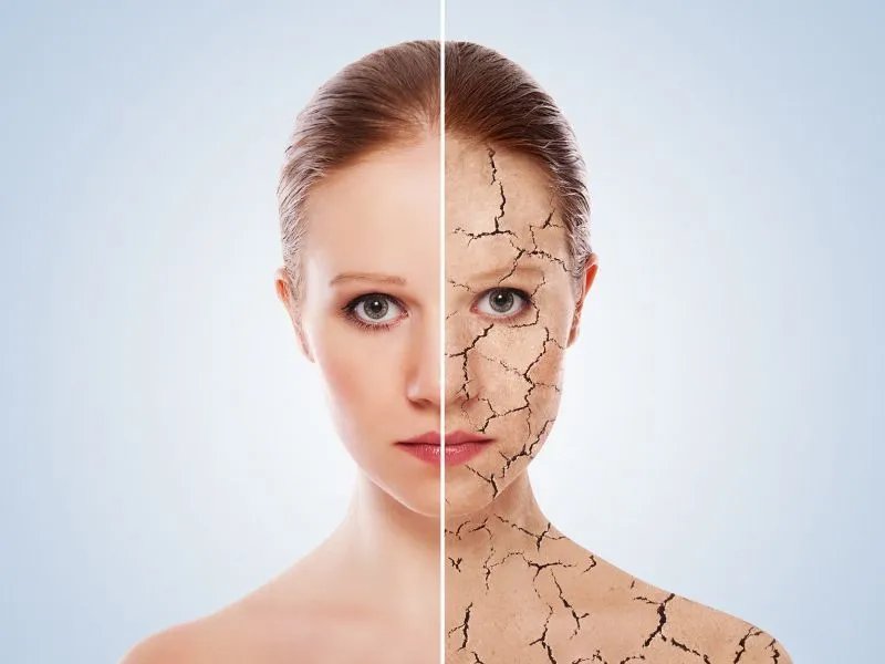 怎么样才能去除痘印