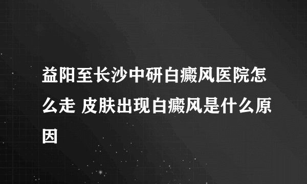 益阳至长沙中研白癜风医院怎么走 皮肤出现白癜风是什么原因