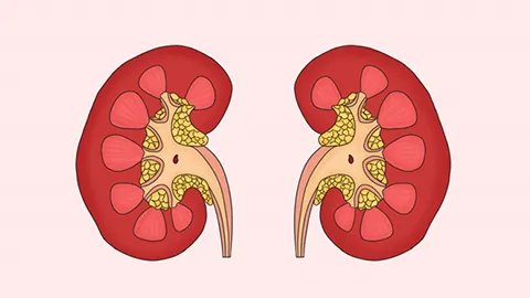 肾部囊肿是什么原因