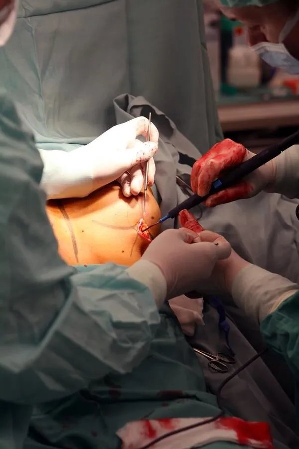 丰胸真的能丰胸么