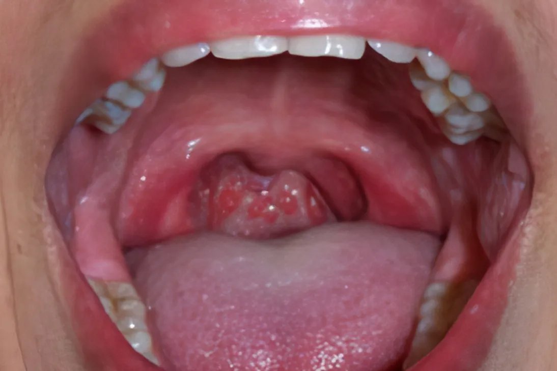 戏腔用哪个部位发声