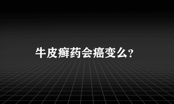 牛皮癣药会癌变么？