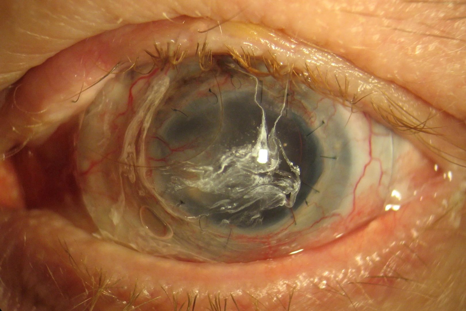 眼睛疾病大全图解