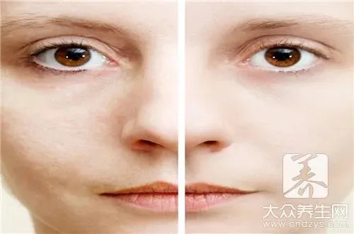 牛奶面膜能去斑吗？