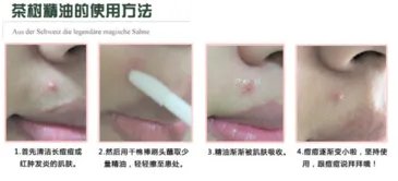 the body shop茶树精油怎么用？美体小铺茶树精油怎么打开