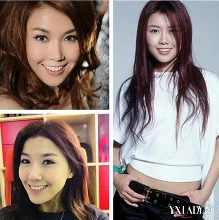 网传王蓉精神病复发砸伤主持人居然站在原地傻笑