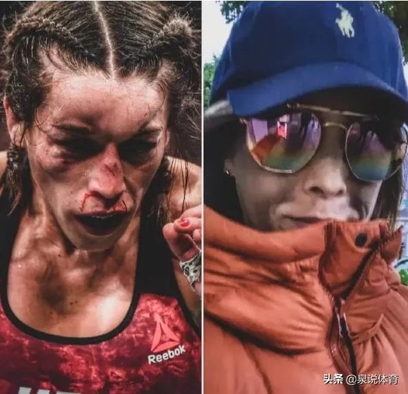 UFC冠军赛后，乔安娜需要进行整形手术而张伟丽却完全不需要，这是为什么？你怎么看？
