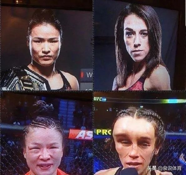 UFC冠军赛后，乔安娜需要进行整形手术而张伟丽却完全不需要，这是为什么？你怎么看？