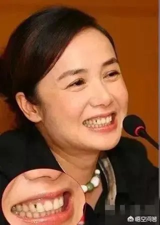 明星们的尴尬瞬间都有哪些？