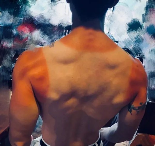 吴尊晒晒伤后的照片，这是在秀肌肉吗？