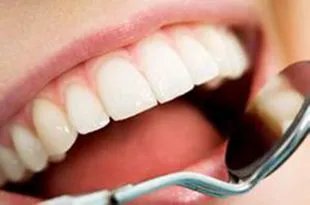 如何美白氟斑牙