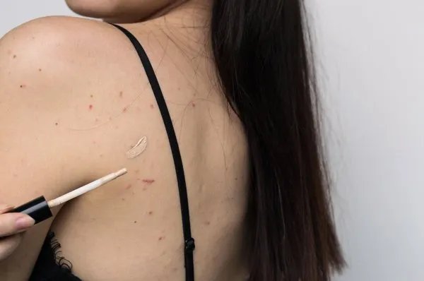 丰胸乳霜对人体有害吗