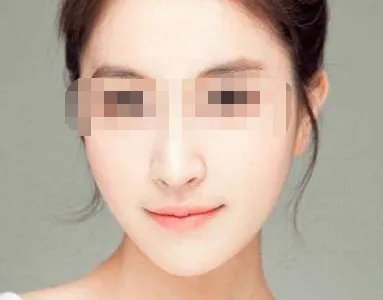 美容去皱方法有哪些