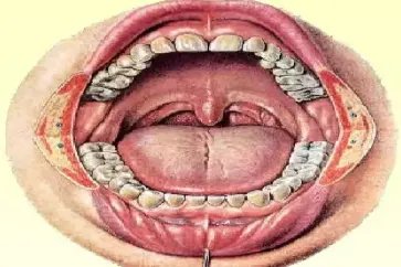 正常的腭垂图片