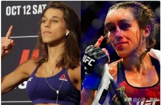 UFC冠军赛后，乔安娜需要进行整形手术而张伟丽却完全不需要，这是为什么？你怎么看？