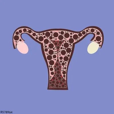 输卵管堵塞吃什么药物 介绍治输卵管堵塞的中西药