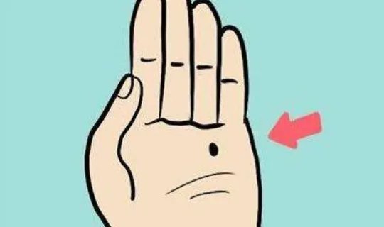 哪些痣是好痣？