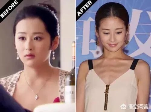 颖儿之前因为胖被网友吐槽，为什么如今瘦下来了依旧被说？