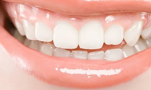 种植牙术后的注意事项